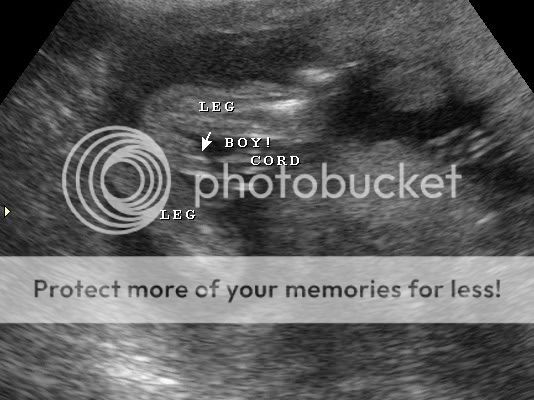 18 Weeks sonogram...Oh, BOY! - BabyCenter